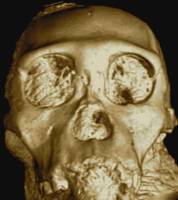 Australopithecus sediba skull