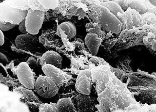 black plague germs
