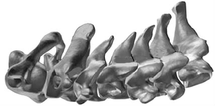 cervical vertebrae human