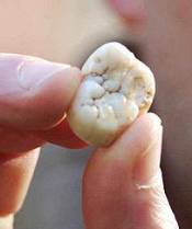 gigantopithecus molar