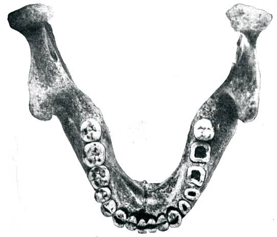 Mauer Jaw, superior aspect