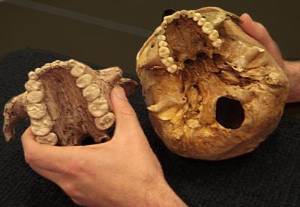 teeth of paranthropus boisei