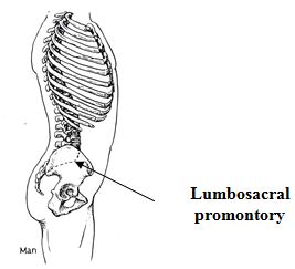 lumbosacral promontory